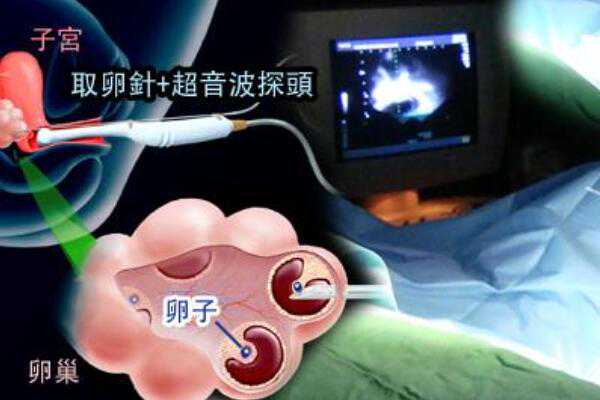 中国试管婴儿提供供卵么,湖北省人民医院试管婴儿医生技术怎么样_孕妇超声检