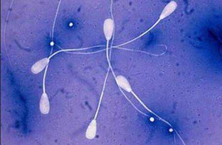 兴海县代孕第三代,助孕男性精子异常应该怎么做试管婴儿-廊坊供卵费用_胚胎移