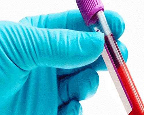 南方试管捐卵_试管婴费用,试管婴儿流程是什么？试管婴儿怎么取精子卵子？