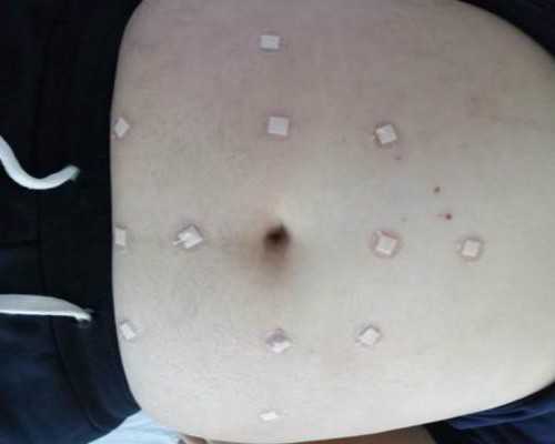 南昌包出生 2023南昌供卵试管婴儿医院排名，附供卵试管成功率及费用一览 ‘孕