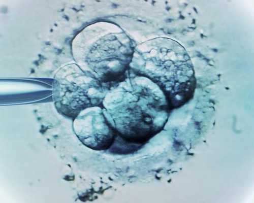 德州人民医院试管婴儿成功率 2023德州市人民医院试管婴儿生男孩费用一览 ‘生