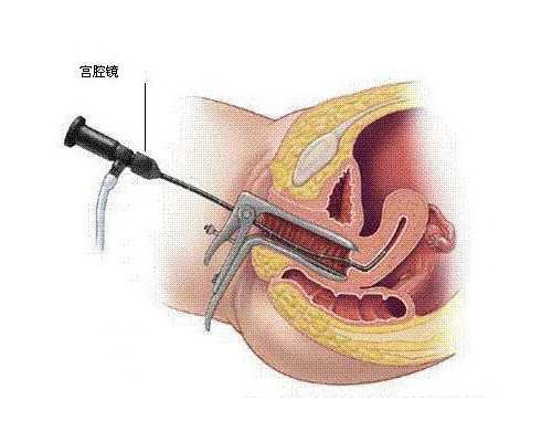 供卵试管婴儿成功率大概有多少啊,湖南哪家医院可以做供卵试管?,湖南供卵试管