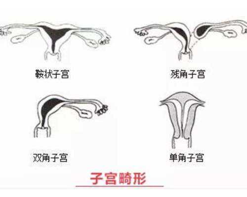 国内三代试管私立医院,湖南中信湘雅试管一代费用,湖南正规医院供卵试管供卵