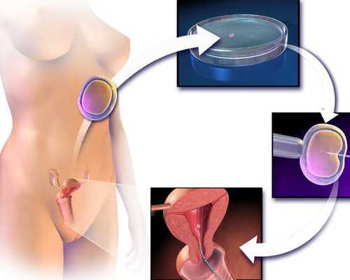 南京御宝宝供卵,北京三代试管婴儿捐卵试管生孩子公司大全-柬埔寨供卵试管费