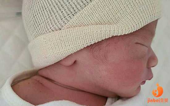 【湖南湘雅医院可以做供卵试管吗】已生二胎7.4斤男宝一枚，说说孕期症状